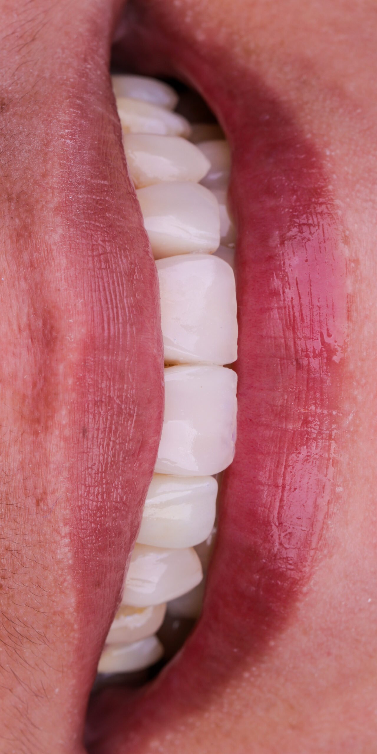 Estética Dental